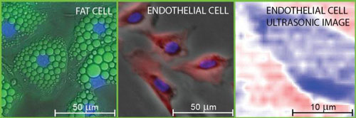 Fluorescence Micrographs of Fat and Endothelial Cells