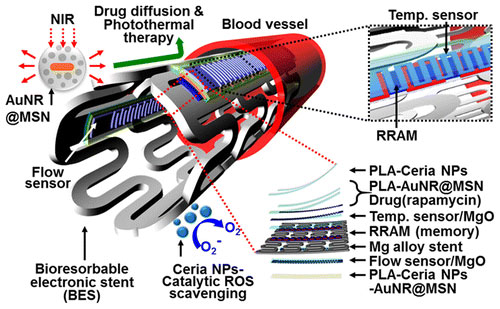 Bioresorbable Electronic Stent Integrated with Therapeutic Nanoparticles