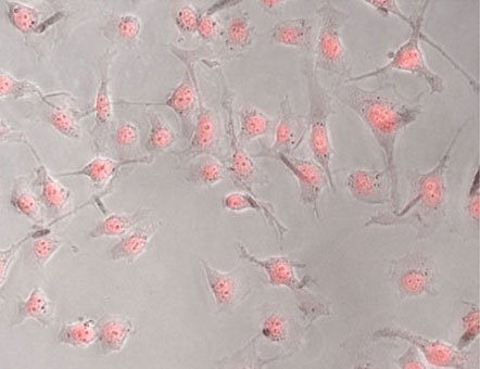 The cells in this image have turned fluorescent pink