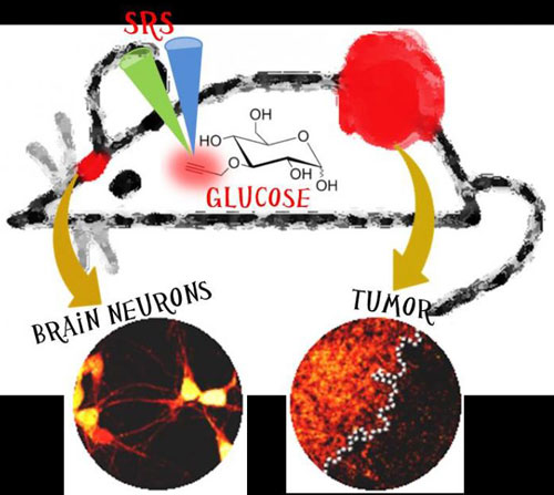 Stimulated Raman Scattering Imaging of Glucose Uptake Activity