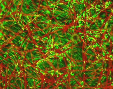 TQ1 fibres (red) with live embryonic chicken cardiomyocytes growing on it (green).
