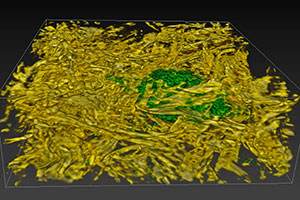 microscopic fungi
