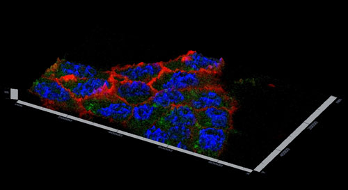 A confocal micrograph showing HCT 116 cancer cells containing drug delivery nanoparticles