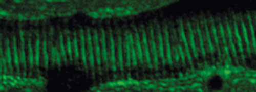Equally spaced actin rings form in the developing tracheal tubules of fruit flies.
