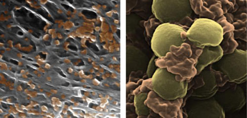 Targeted Binding of Platelet-Membrane-Coated Nanoparticles