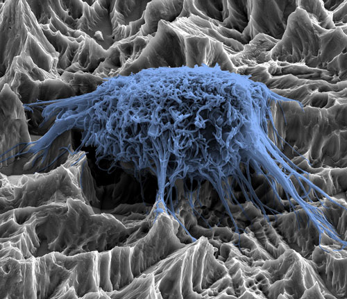A scanning electron microscope image shows a properly grown cell on a dental implant