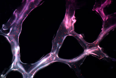 hydrogel embedded with triple helix microRNA particles
