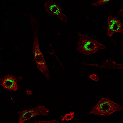 Mouse macrophages (red) engulf silica nanoparticles (green)