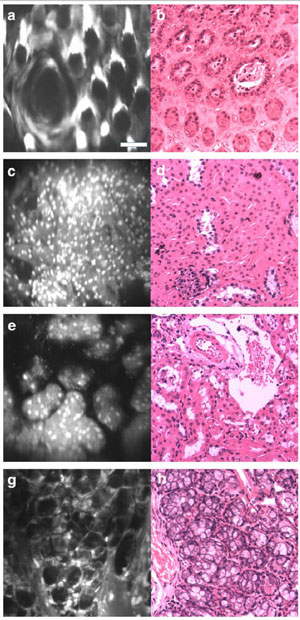 Microscope images of tissue