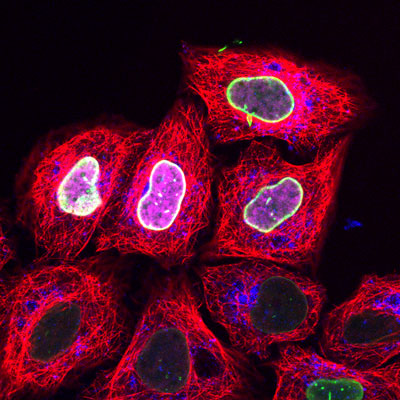 the nuclear envelope protein Lamin A was stained with fluorescently labeled trisNTA 
