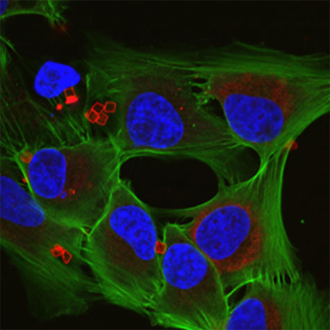 Laser scanning confocal microscopy image of SUM159 human breast cancer cells incubated with cubic capsules