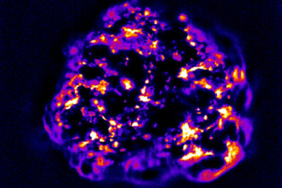 Carbon nanotubes that have infiltrated a tumor give off light