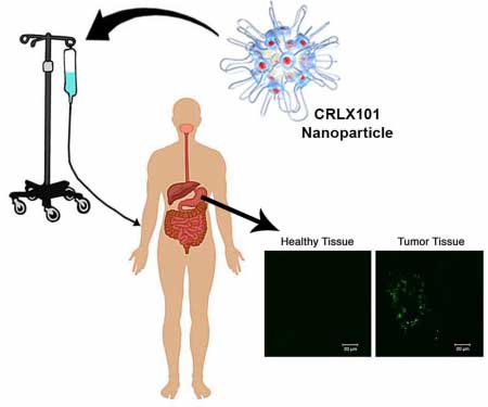 nanoparticle therapeutic CRLX101