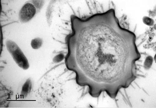 Nanopillars on a Rat-Tailed Maggot