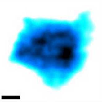 Video imaging by high-speed AFM captures native nuclear pore complexes at work