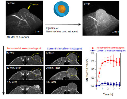 nanomachine contrast agent makes possible the detection of cancer with a higher contrast than current contrast agents
