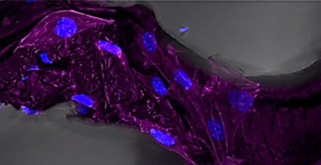 Confocal fluorescence microscope image of C2C12 myoblasts on graphene foam