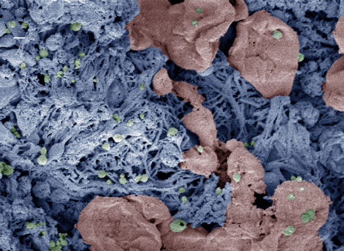 Nanoparticles (green) help form clots in an injured liver