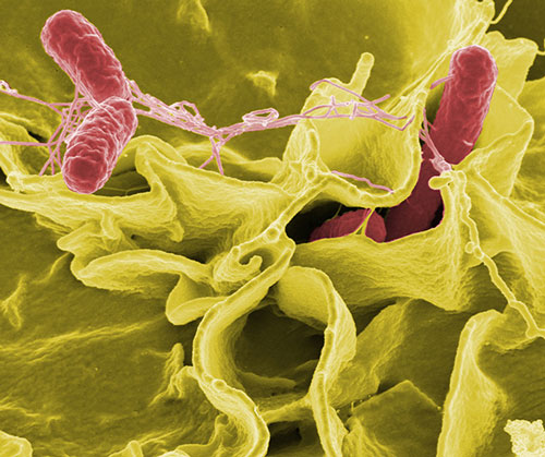 electron micrograph showing Salmonella typhimurium (red) infecting human cells