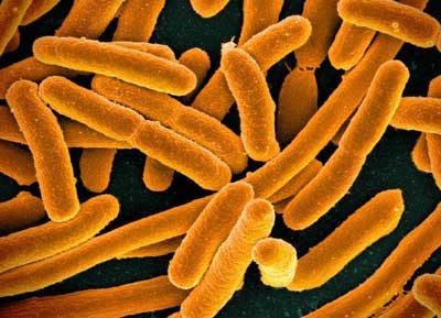  E. coli