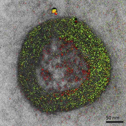 Color electron micrograph of an endosome, a cell organelle