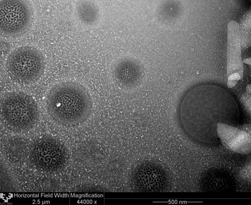 Lipid nanoparticles