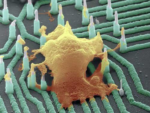 a colorized SEM image of a neuron (orange) interfaced with a nanowire array