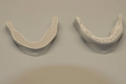 A jaw bone 3D-printed with the cellulose ink