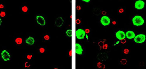 T cells (red) and tumor cells (green) incubated with control particles (left) or immunoswitch particles (right)