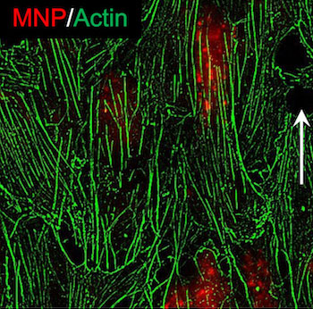 Under the influence of a magnet, nanoparticles realign actin filaments in endothelial cells