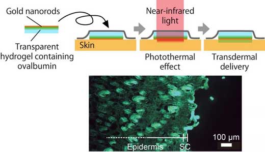 Near-infrared light produces a photothermal effect on gold nanorods in a hydrogel skin patch