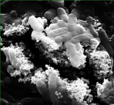 Clusters of nanoparticles with phage viruses attached find and kill Escherichia coli bacteria