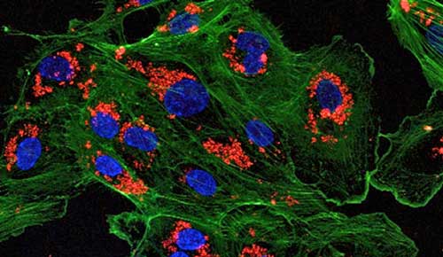 A microscopic image of endothelial cells treated with drug-loaded nanoparticles