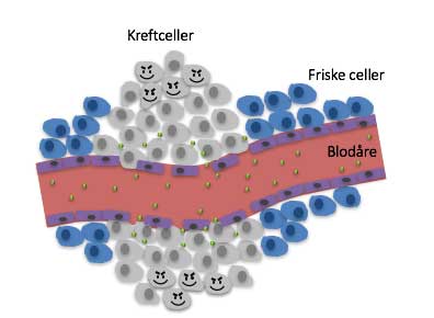 Blood vessels supplying the cancer cells (kreftceller in the illustration) have porous walls, while the sections of blood vessels passing through healthy cells are not porous