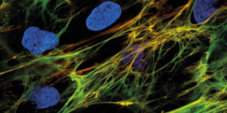 Cells are surrounded by extracellular matrix fibres
