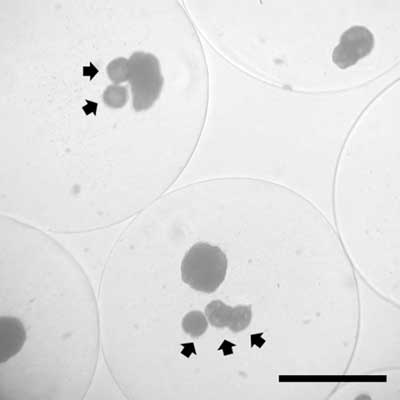 Co-Encapsulated Islets and Microspheres