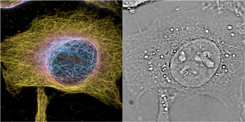 HeLa cells maximum intensity projection of 3D 2nd order bSOFI of labelled microtubules, color encodes z-position with one slice of the complementing 3D phase image providing cellular context