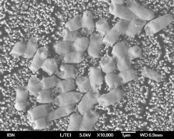 E. coli bacteria destroyed by the anti-bacterial coating made from zinc oxide nanopillars. 