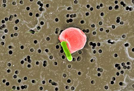 Electromicroscopic image of a RBC microswimmer