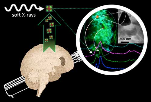 Synchrotron soft-X-ray nano-imaging and spectromicroscopy reveals iron and calcium biomineralization in Alzheimer's disease amyloid plaques
