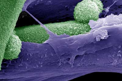 false colored scanning electron micrograph, where mineral phase (biomimetic bone like hydroxyapatite) is denoted by green and the matrix deposited by mesenchymal stem cells is shown in purple