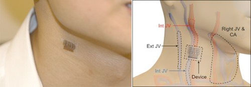 flexible blood pressure monitor patch attached to neck