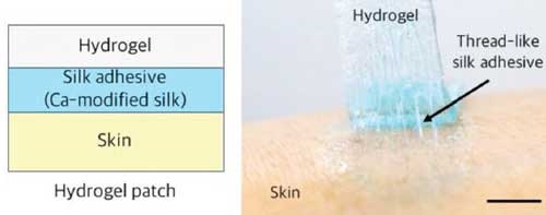 Schematic and photograph of a hydrogel patch adhered on the human skin through the silk adhesive