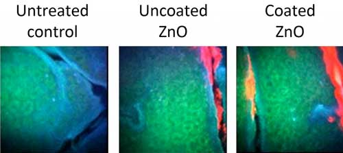 Multiphoton images of human skin at a depth of 15-20 ?m below the skin surface in volunteers after application of uncoated and silicone-coated zinc oxide nanoparticles suspended in a commercial sunscreen