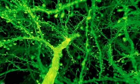 A forest of dendritic spines protrudes from the branches of neurons in the mouse cortex
