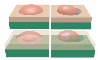 different configurations of the droplet within the opening – hole