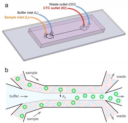Microfluidics Device to separate cancer cells