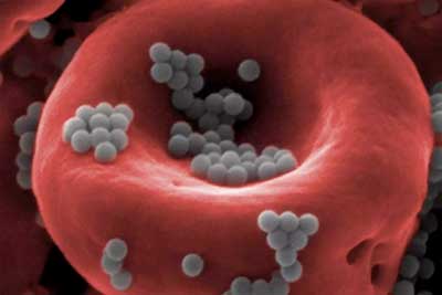 Nanoparticles (gray) attached to a red blood cell