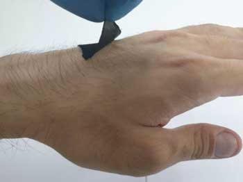 A graphene-based adhesive biosensor attached to skin