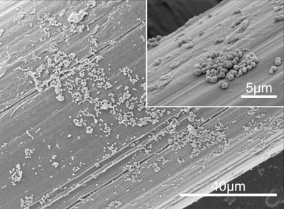 SEM Micrographs of the S. aureus Biofilm Formed on the Surgical Mesh Surface